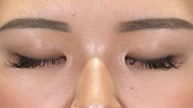 Postoperative Condition Part 1