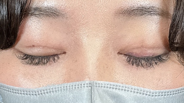 Postoperative Condition Part 1