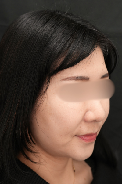 手術前の状態 その1