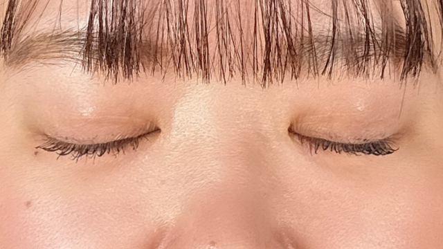 Postoperative Condition Part 1