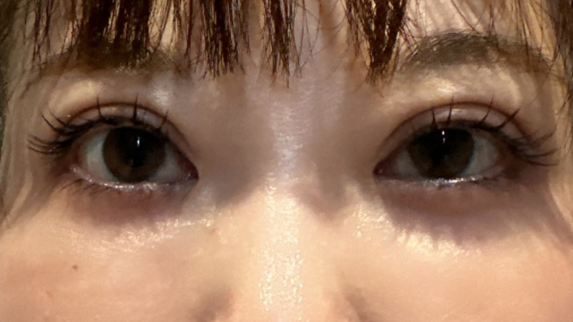 Postoperative Condition Part 1