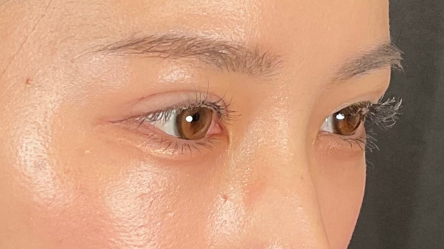 Postoperative Condition Part 1