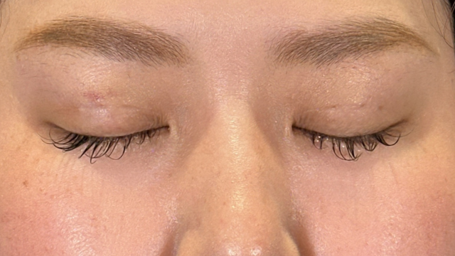 Postoperative Condition Part 1