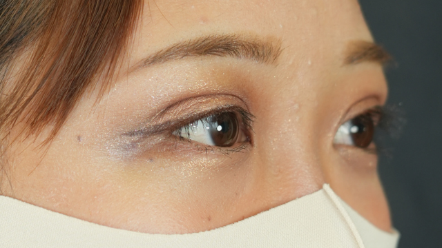 Postoperative Condition Part 1