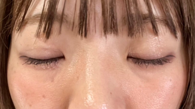 Postoperative Condition Part 1