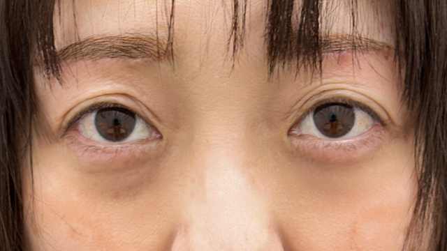 Postoperative Condition Part 1