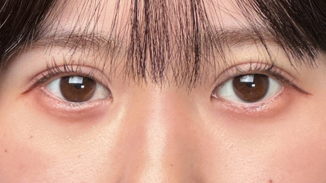 Postoperative Condition Part 1