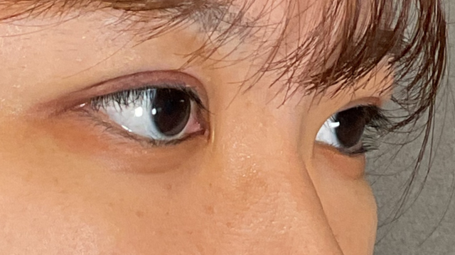 Postoperative Condition Part 1