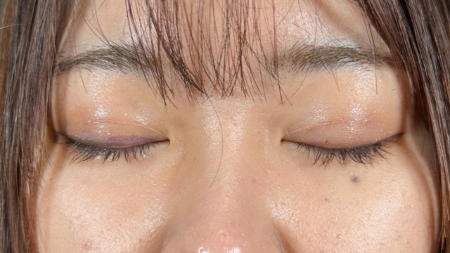 Postoperative Condition Part 1