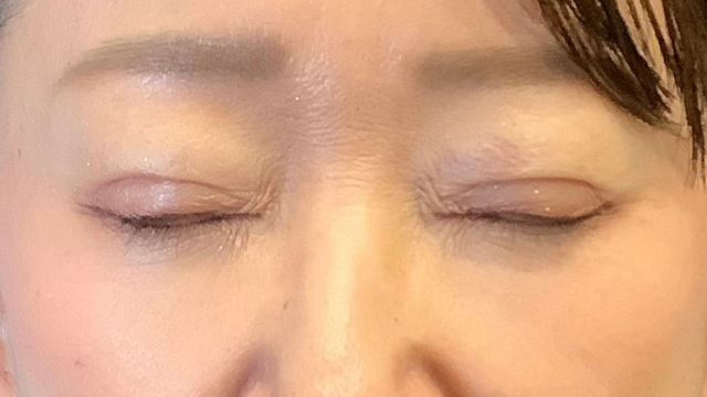 Postoperative Condition Part 1