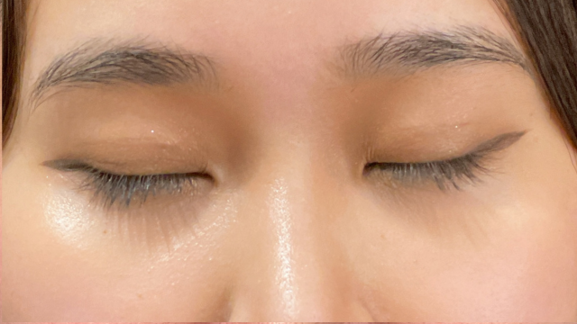 Postoperative Condition Part 1