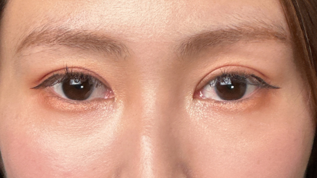 Postoperative Condition Part 1