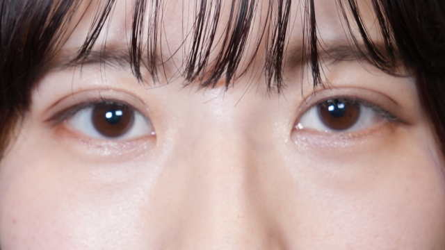 Postoperative Condition Part 1