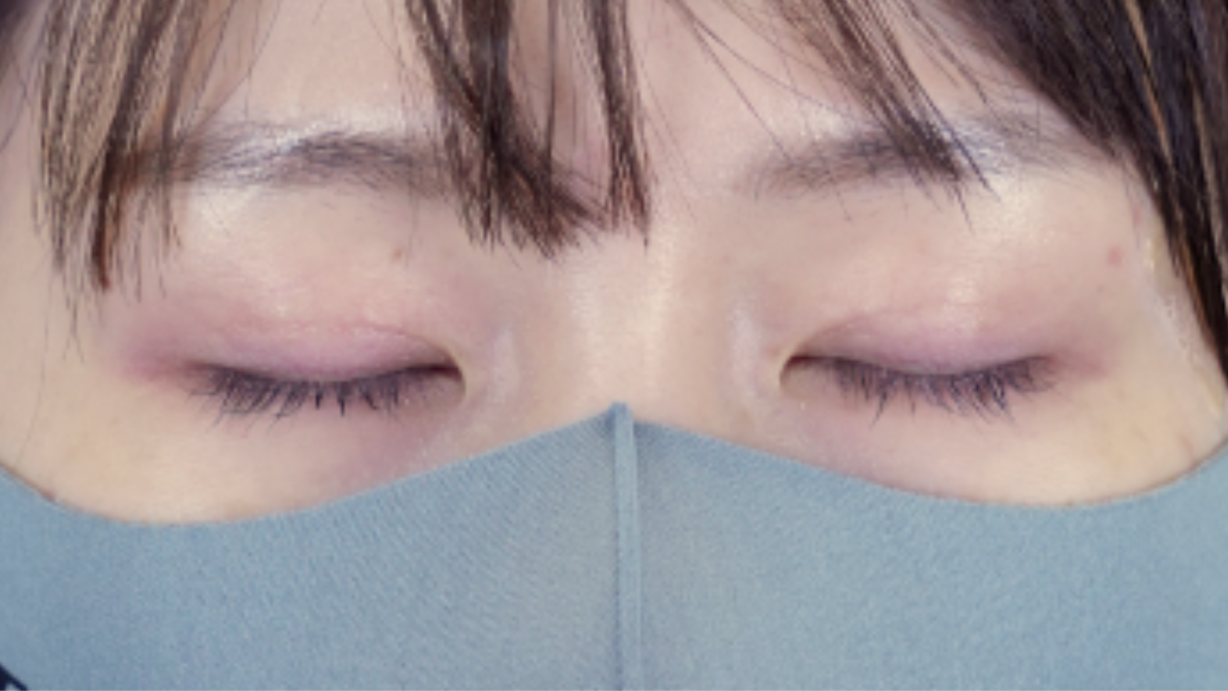 Postoperative Condition Part 1