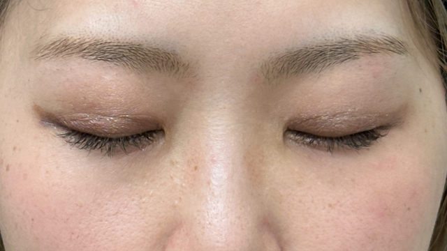 Postoperative Condition Part 1