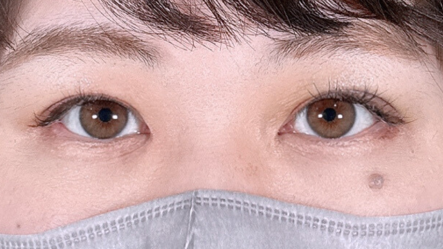 Postoperative Condition Part 1