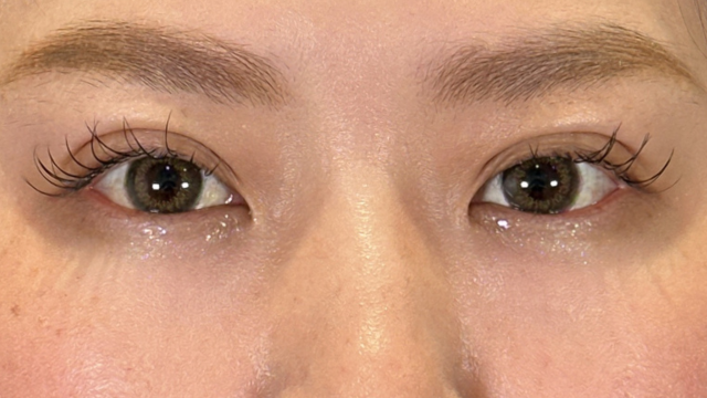 Postoperative Condition Part 1