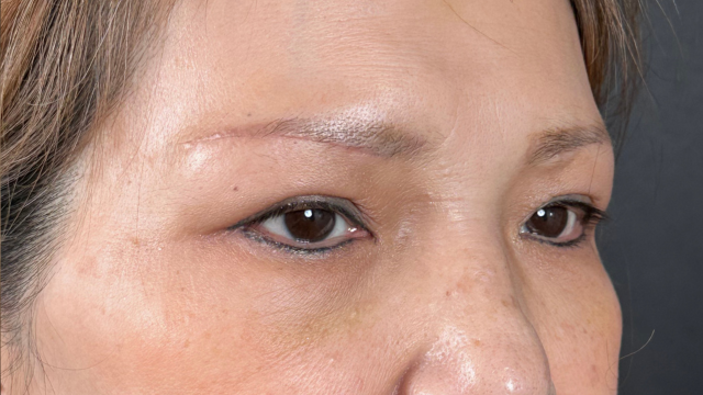 Postoperative Condition Part 1