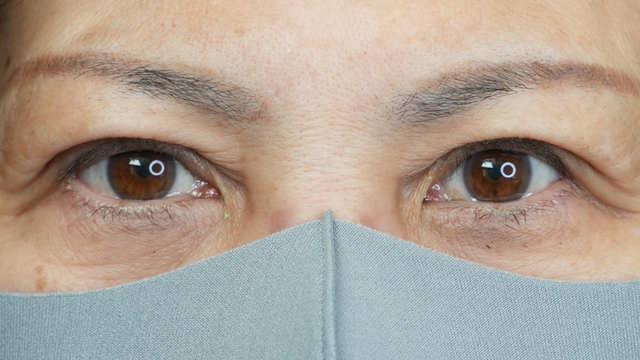 Postoperative Condition Part 1