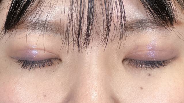 Postoperative Condition Part 1