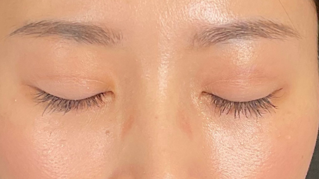 Postoperative Condition Part 1