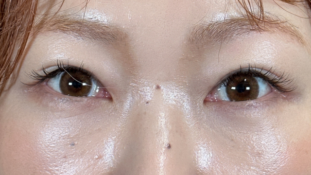 Postoperative Condition Part 1