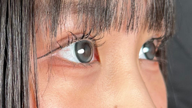 Postoperative Condition Part 1