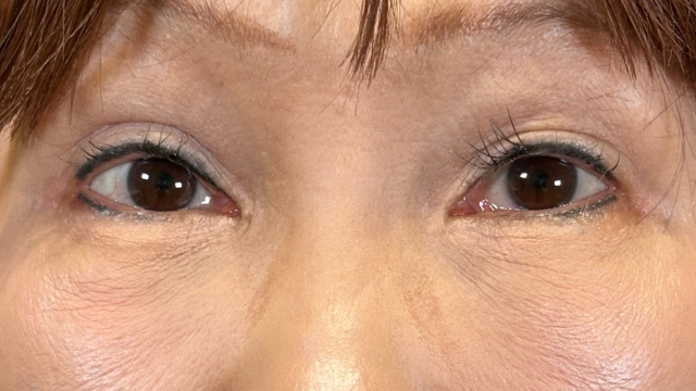 Postoperative Condition Part 1