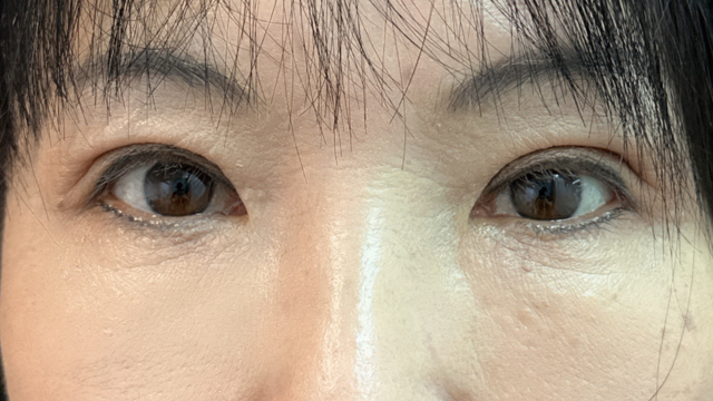 Postoperative Condition Part 1