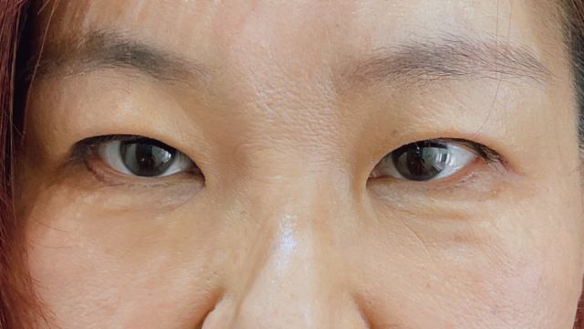 Postoperative Condition Part 1