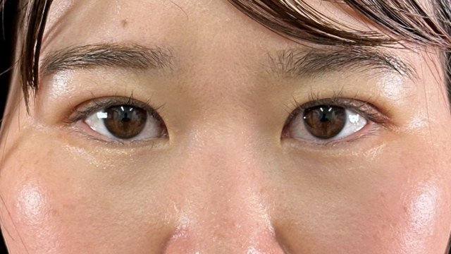 Postoperative Condition Part 1