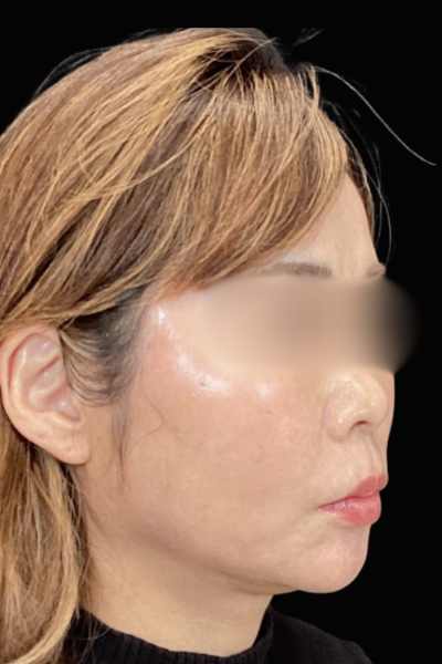 Postoperative Condition Part 1