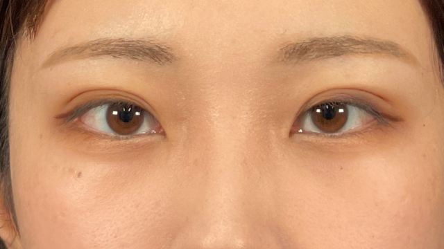 Postoperative Condition Part 1