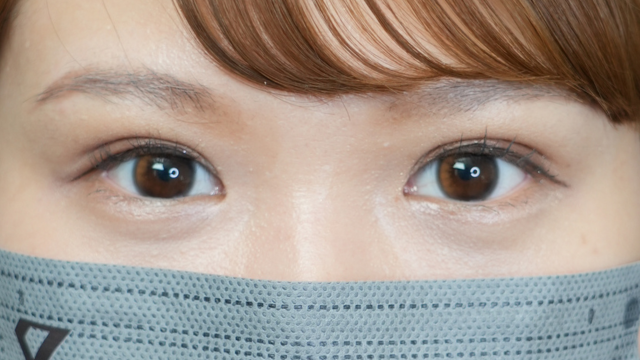 Postoperative Condition Part 1