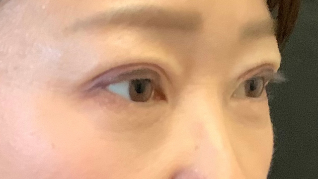 Postoperative Condition Part 1