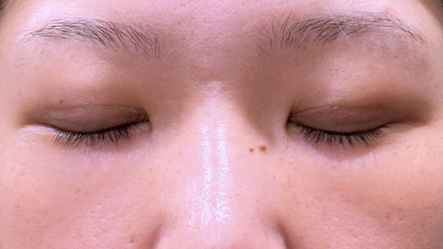 Postoperative Condition Part 1