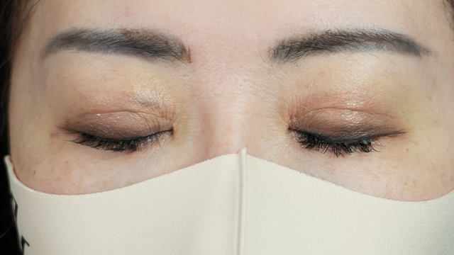 Postoperative Condition Part 1