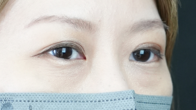 Postoperative Condition Part 1