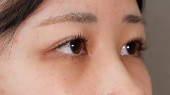 Postoperative Condition Part 1