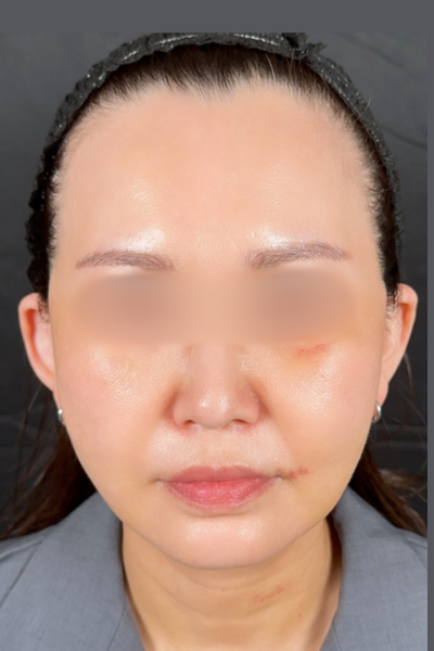 Postoperative Condition Part 1