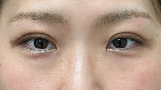 Postoperative Condition Part 1