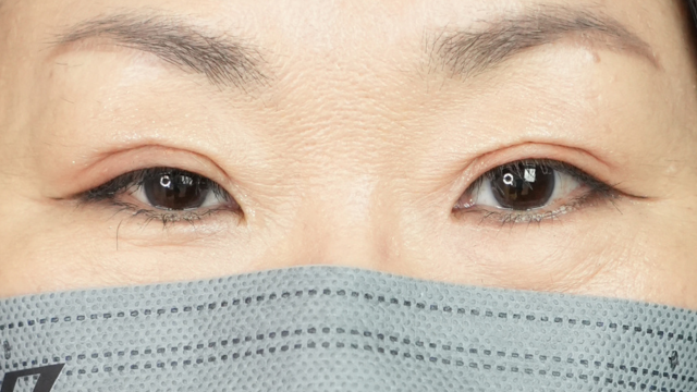 Postoperative Condition Part 1