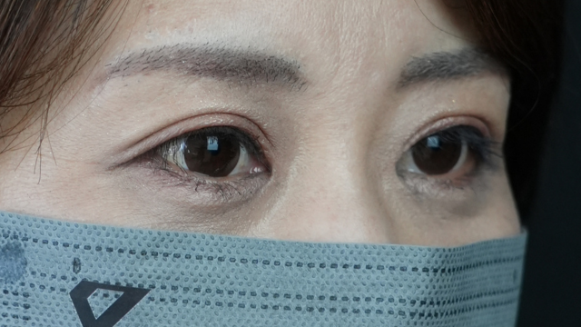 Postoperative Condition Part 1