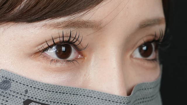 Postoperative Condition Part 1