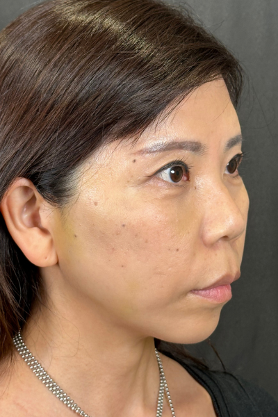 Postoperative Condition Part 1