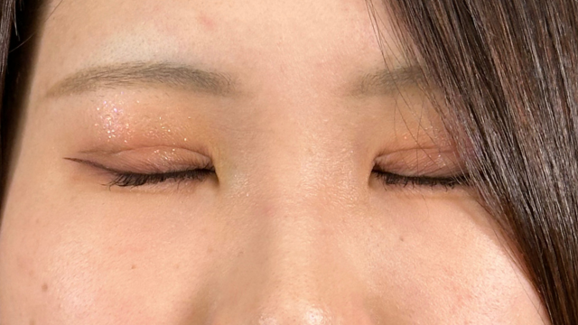 Postoperative Condition Part 1