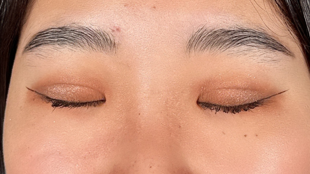 Postoperative Condition Part 1