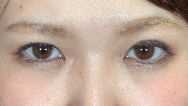 Postoperative Condition Part 1