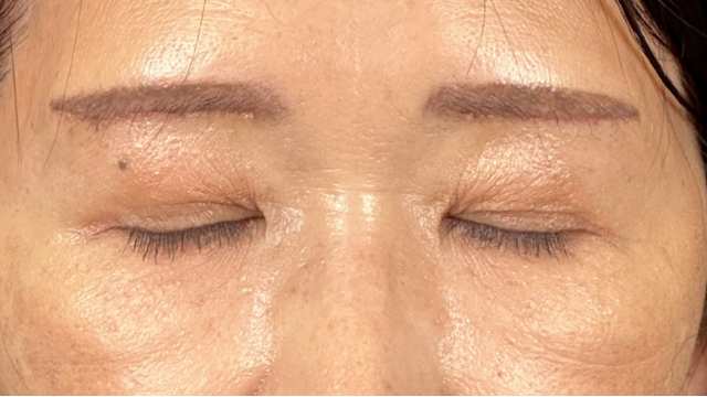 Postoperative Condition Part 1