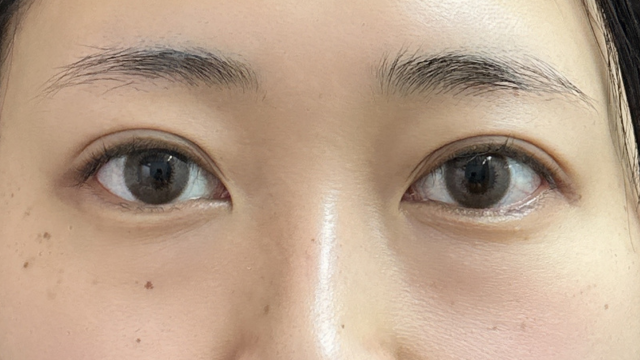 Postoperative Condition Part 1